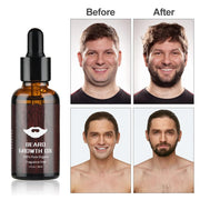 Beard Growth Kit Barber Hair Growth Enhancer Set Oil Serum Nourishing Essential Facial Care Kit Men Titanium Roller Balm Comb